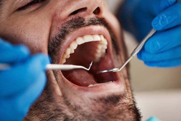 Best Weekend Emergency Dentist in Lyman, WY