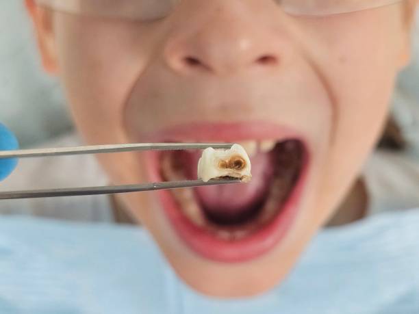Best Pediatric Emergency Dentist in Lyman, WY